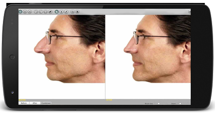 Plastic Surgery Simulator App Android Free Download